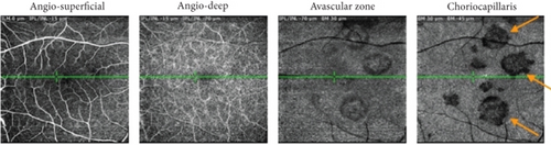 Details are in the caption following the image Details are in the caption following the image
