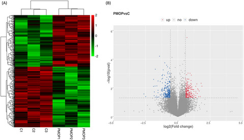 Microarray analysis of circRNAs sequencing profile in exosomes derived from bone marrow mesenchymal stem cells in postmenopausal osteoporosis patients