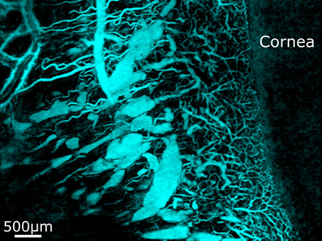 Label-free volumetric imaging of conjunctival collecting lymphatics ex vivo by optical coherence tomography lymphangiography