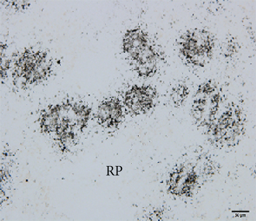 Details are in the caption following the image