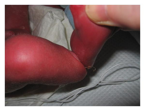 Details are in the caption following the image