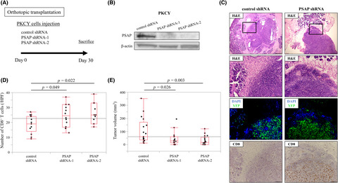 Prosaposin, tumor-secreted protein, promotes pancreatic cancer progression by decreasing tumor-infiltrating lymphocytes