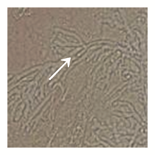 Details are in the caption following the image