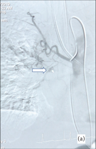 Details are in the caption following the image
