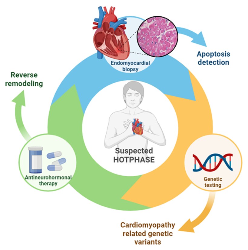 Apoptosis, a useful marker in the management of hot-phase cardiomyopathy?