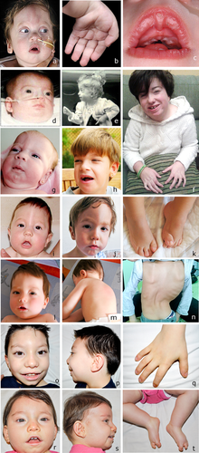 Details are in the caption following the image Details are in the caption following the image