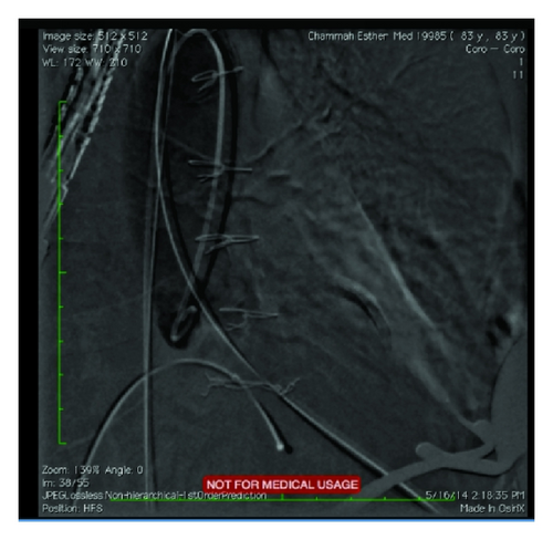 Details are in the caption following the image