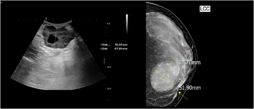 Details are in the caption following the image Details are in the caption following the image