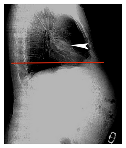 Details are in the caption following the image Details are in the caption following the image