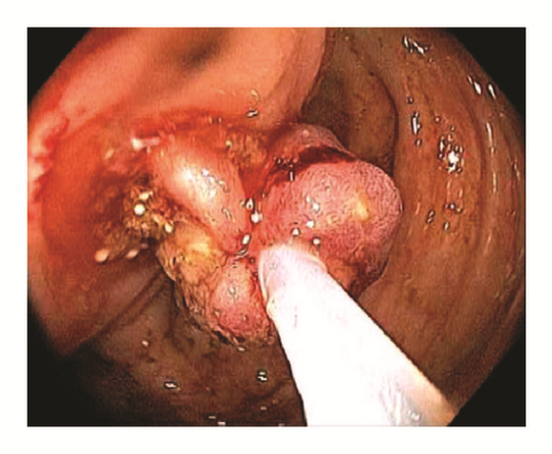 Details are in the caption following the image Details are in the caption following the image
