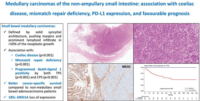 Medullary carcinomas of the nonampullary small intestine: association with coeliac disease, mismatch repair deficiency, PD-L1 expression, and favourable prognosis