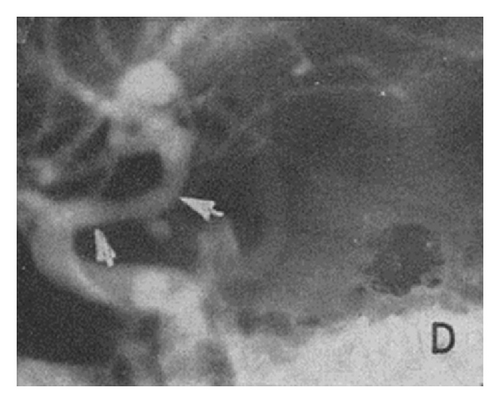 Details are in the caption following the image