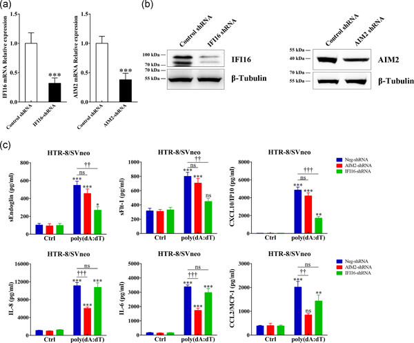 Elevated cell-free fetal DNA contributes to placental inflammation and antiangiogenesis via AIM2 and IFI16 during pre-eclampsia