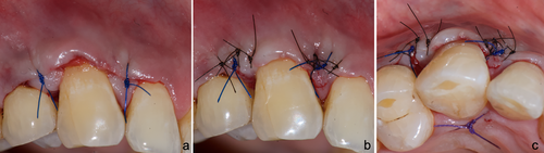 Details are in the caption following the image Details are in the caption following the image