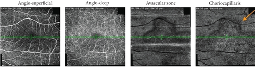 Details are in the caption following the image Details are in the caption following the image
