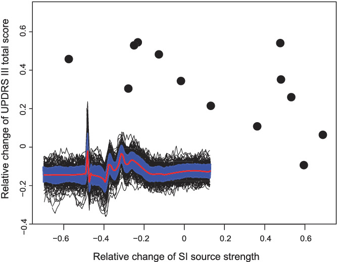Modulation of sensory cortical activity by deep brain stimulation in advanced Parkinson's disease