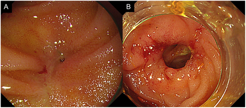 Details are in the caption following the image Details are in the caption following the image