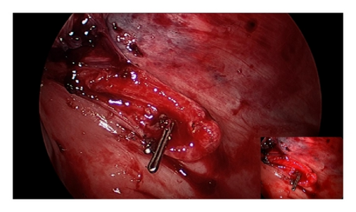 Details are in the caption following the image Details are in the caption following the image