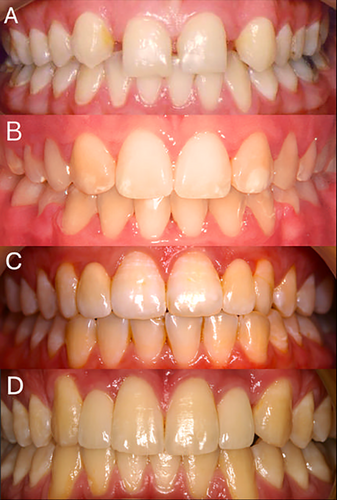 Details are in the caption following the image Details are in the caption following the image