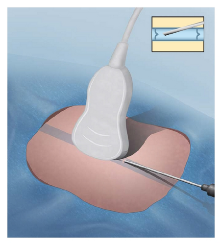 Details are in the caption following the image