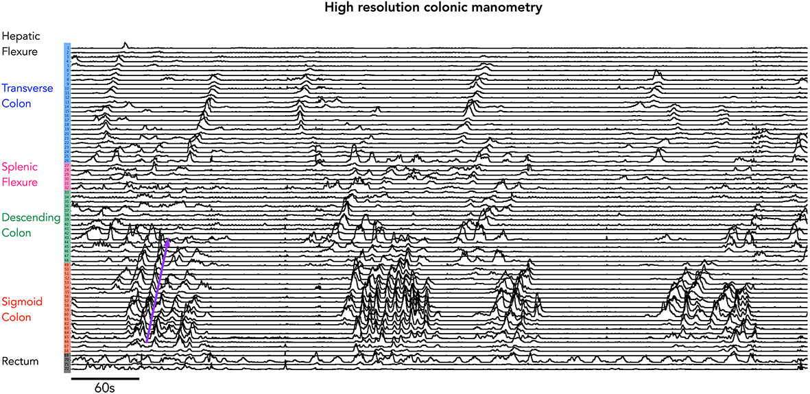 From the organ bath to the whole person: a review of human colonic motility