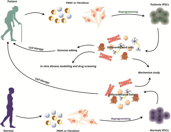 Induced pluripotent stem cells (iPSCs) as game-changing tools in the treatment of neurodegenerative disease: Mirage or reality?