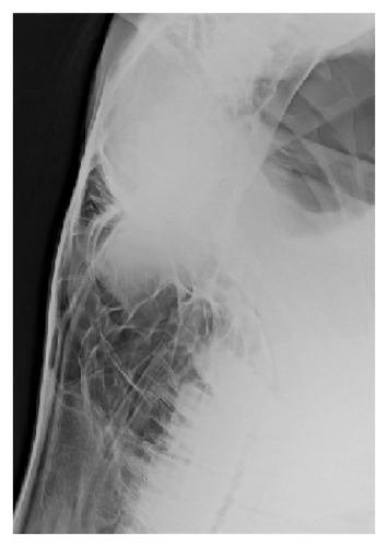 Details are in the caption following the image