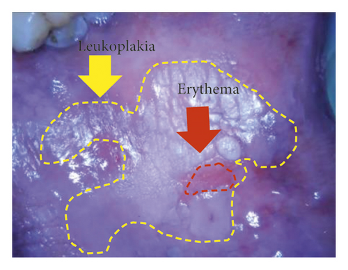 Details are in the caption following the image Details are in the caption following the image
