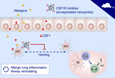 Colony-stimulating factor 1 and its receptor are new potential therapeutic targets for allergic asthma