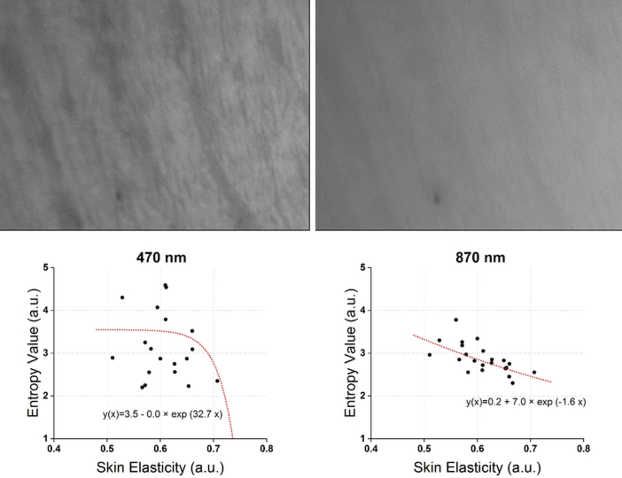 Analysis of relation between skin elasticity and the entropy of skin image using near-infrared and visible light sources