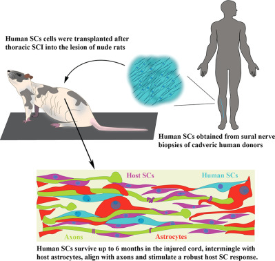 Human Schwann cells exhibit long-term cell survival, are not tumorigenic and promote repair when transplanted into the contused spinal cord