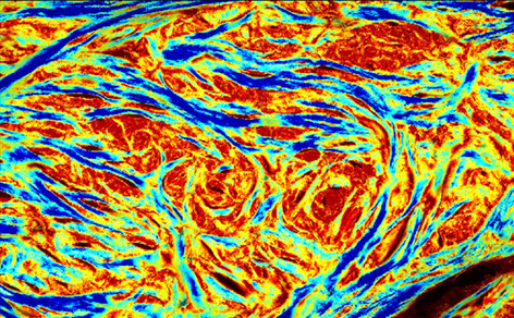 Polarized light microscopy for 3-dimensional mapping of collagen fiber architecture in ocular tissues