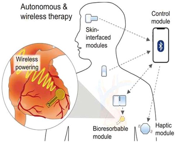 Implantable and biodegradable closed-loop devices for autonomous electrotherapy