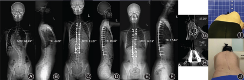 Details are in the caption following the image Details are in the caption following the image