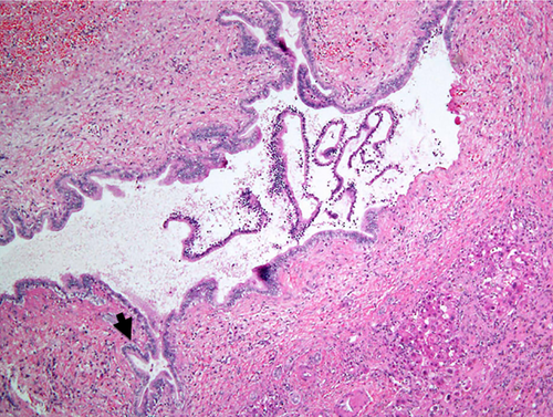 Details are in the caption following the image