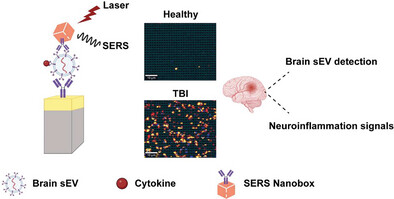 Single Extracellular Vesicle Profiling to Define Brain Specific Traumatic Brain Injury Induced Neuro-Inflammation