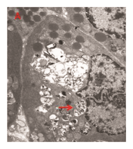 Details are in the caption following the image Details are in the caption following the image