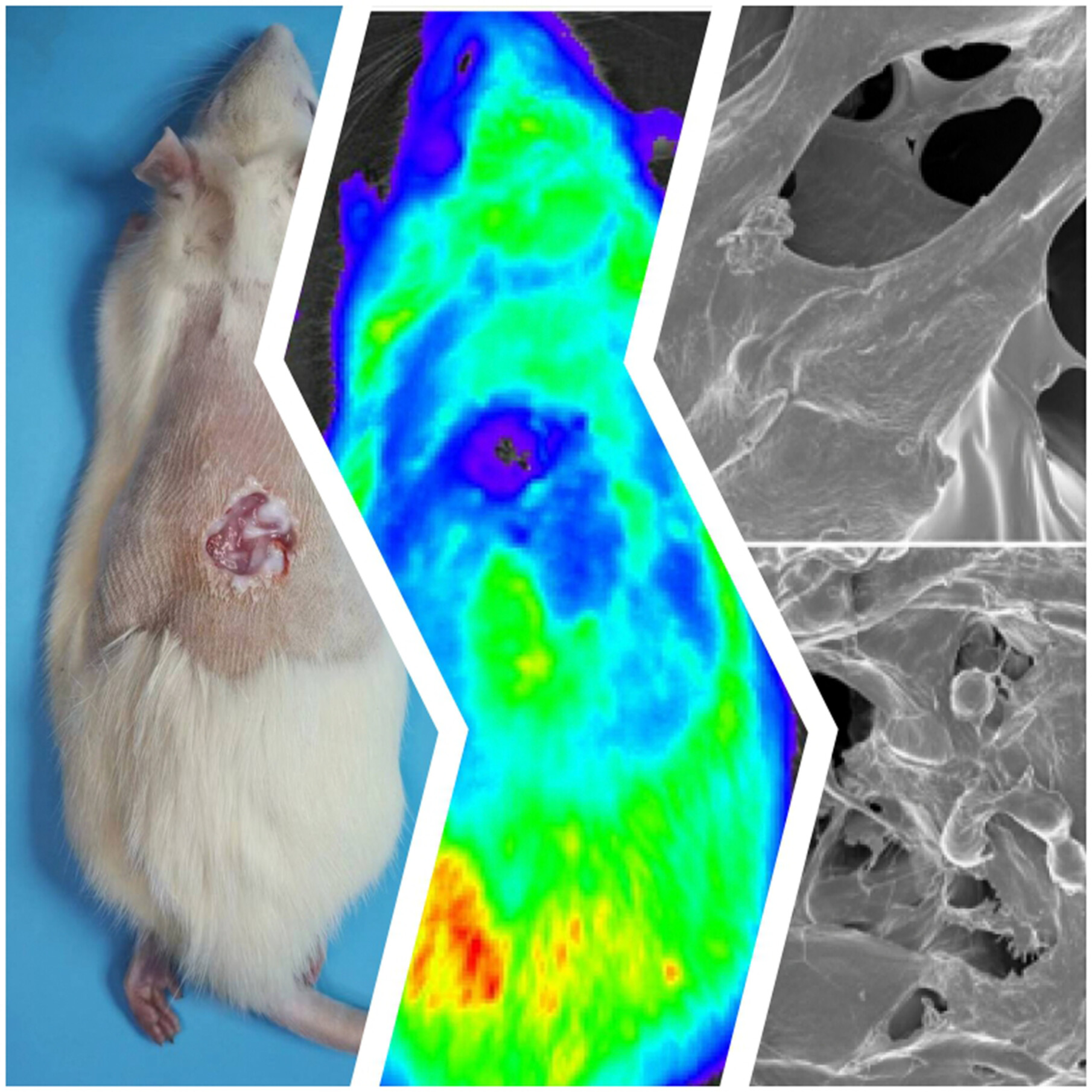 Fish collagen sponge with human umbilical cord mesenchymal stem cells for diabetic wound repair in rats