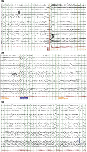 Details are in the caption following the image Details are in the caption following the image