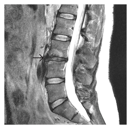 Details are in the caption following the image