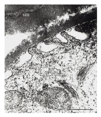 Details are in the caption following the image