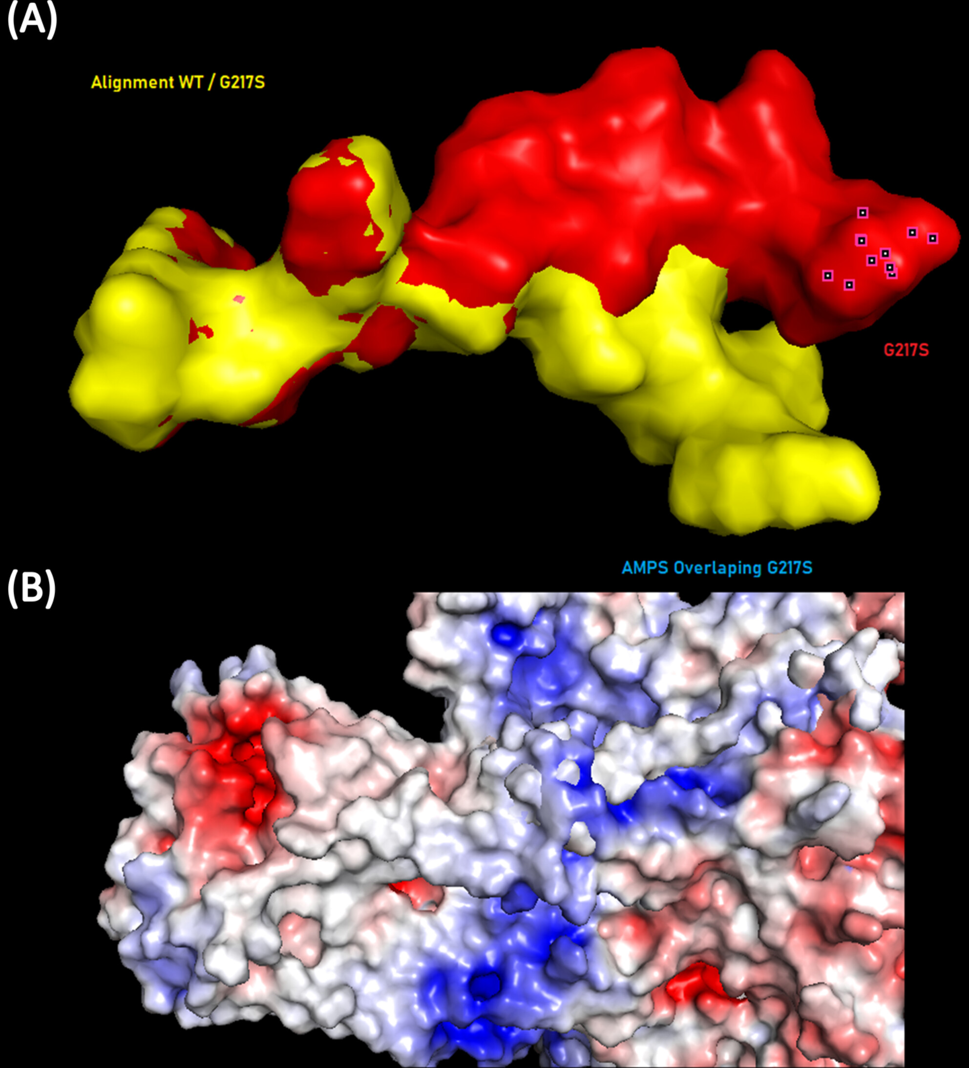 Spastic Paraplegia Type 78 Associated With ATP13A2 Gene Variants in Compound Heterozygosity