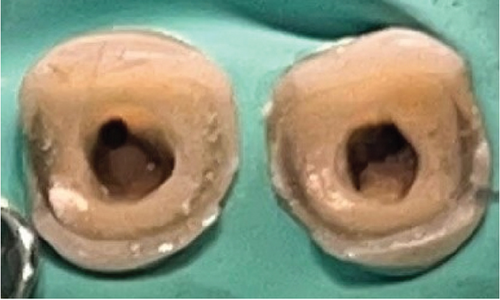 Details are in the caption following the image
