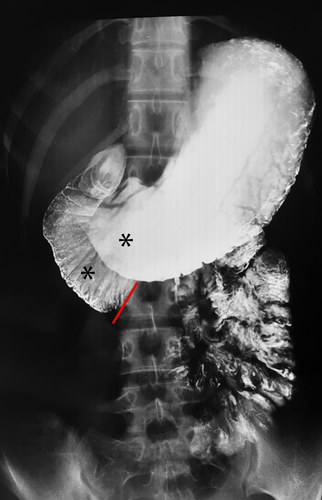 Details are in the caption following the image