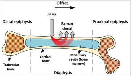 Sensitivity of spatially offset Raman spectroscopy (SORS) to subcortical bone tissue