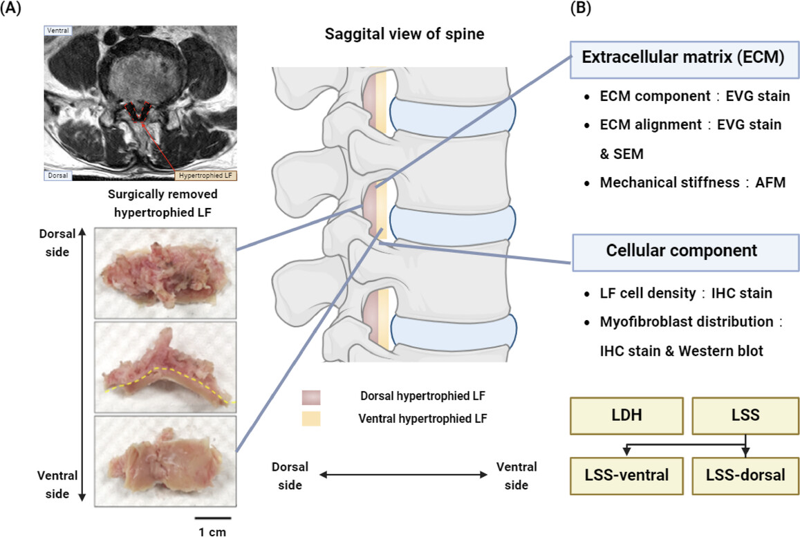 Variations in ECM Topography, Fiber Alignment, Mechanical Stiffness, and Cellular Composition Between Ventral and Dorsal Ligamentum Flavum Layers: Insights Into Hypertrophy Pathogenesis