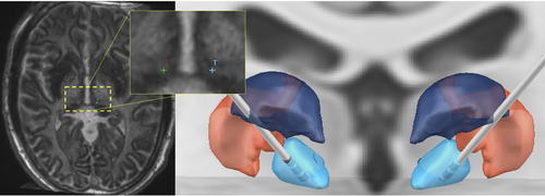Details are in the caption following the image