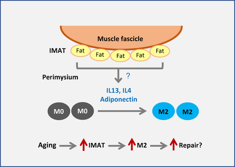 Skewed macrophage polarization in aging skeletal muscle