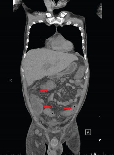 Details are in the caption following the image Details are in the caption following the image
