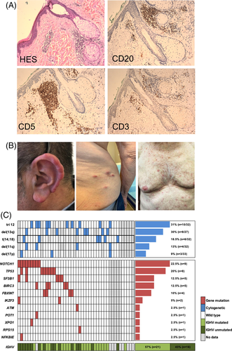 Details are in the caption following the image Details are in the caption following the image